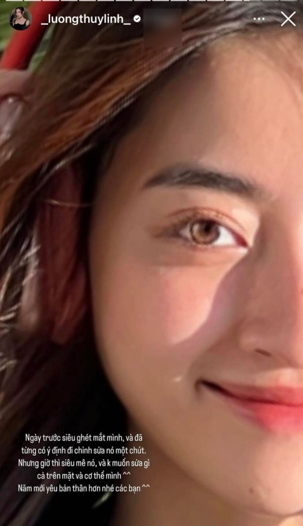 Hóa ra cô từng không thích đôi mắt của mình và muốn chỉnh sửa.