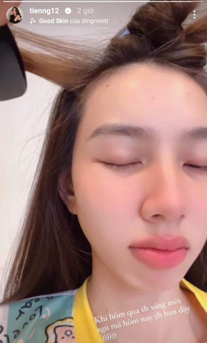 Thùy Tiên thường xuyên bị thiếu ngủ do làm việc quá sức. Thùy Tiên thường xuyên bị thiếu ngủ do làm việc quá sức.