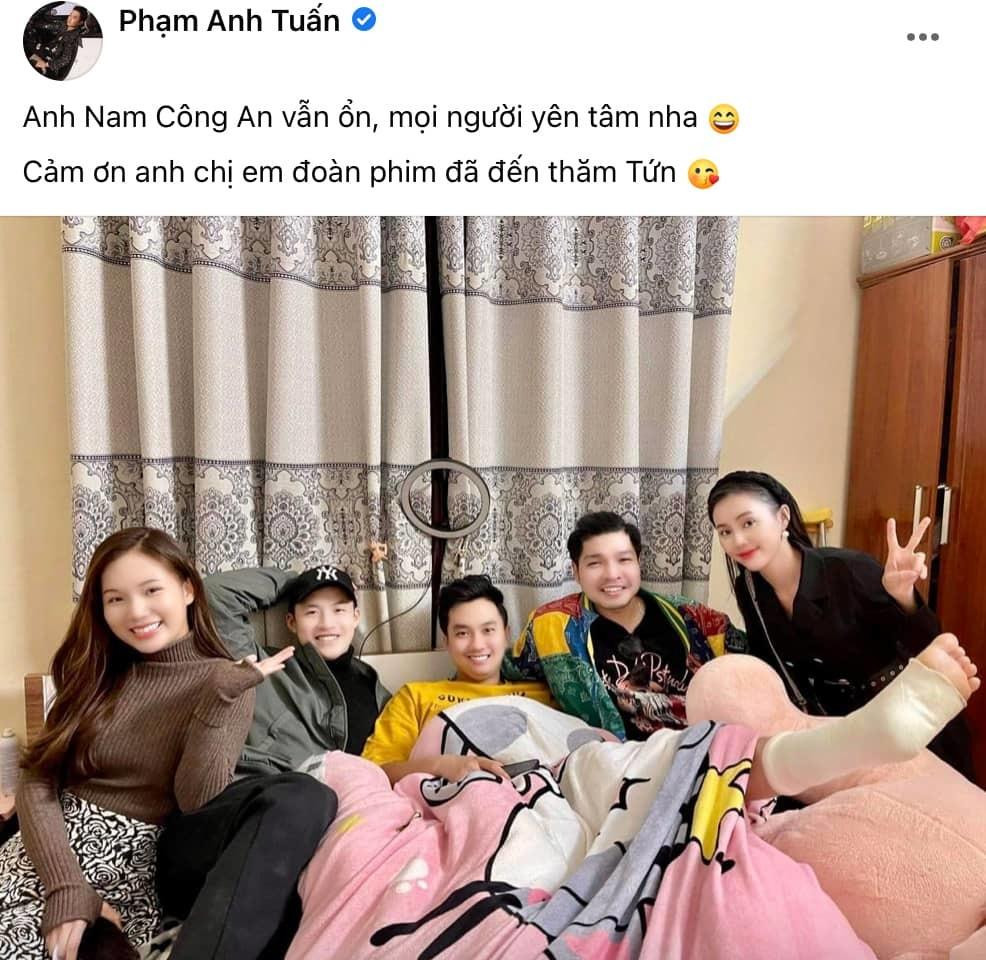 Nam diễn viên đang phải bó bột vì chấn thương Nam diễn viên đang phải bó bột vì chấn thương