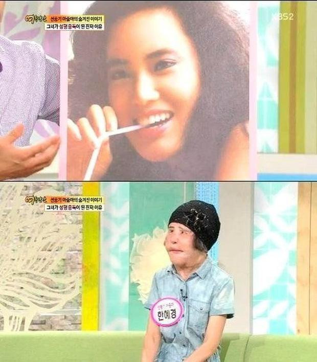 Dù đã được các chuyên gia phẫu thuật giúp đỡ thì Han Mi Ok vẫn không lấy lại được dung nhan ngày trước.