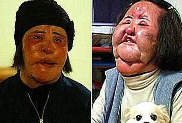 Hình ảnh khiến nhiều người sợ hãi.