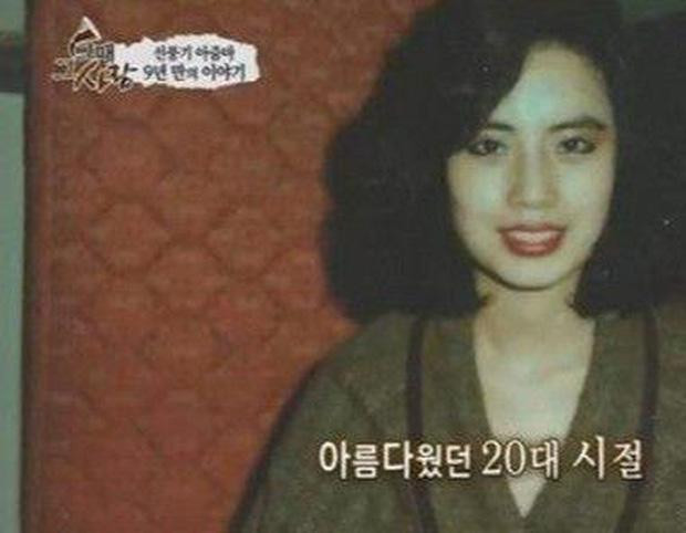 Han Mi Ok khi chưa phẫu thuật.