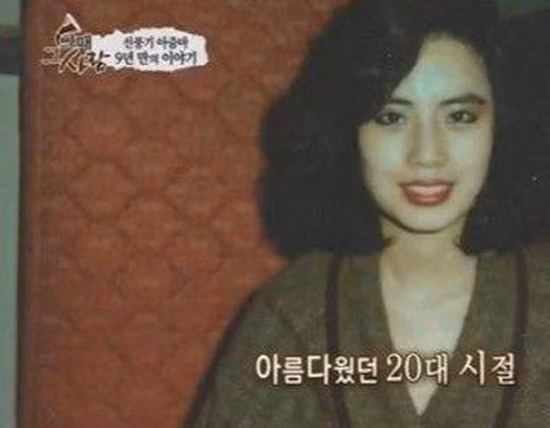 Han Mi Ok khi chưa phẫu thuật.