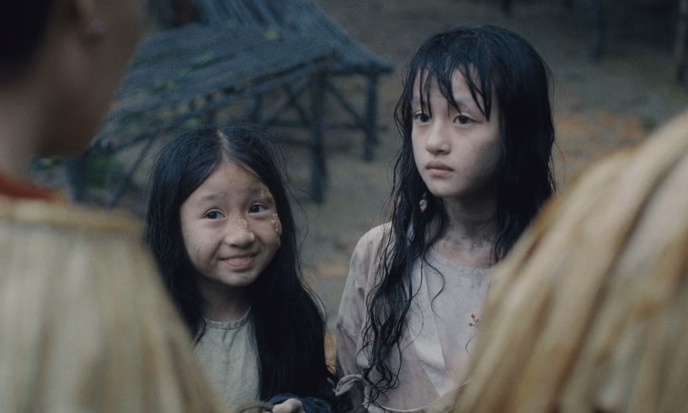 Cám e dè nhút nhát từ nhỏ vì gương mặt sần sùi.