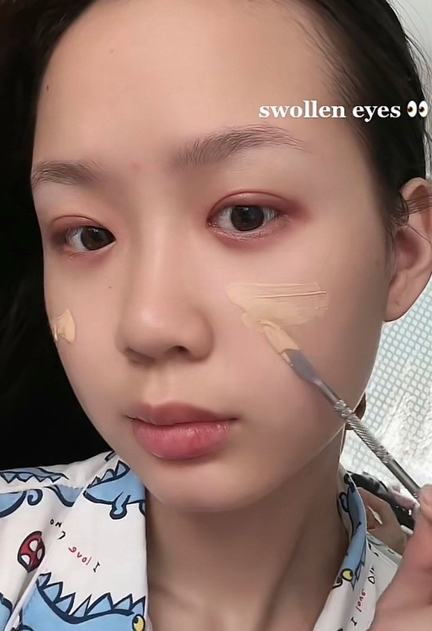 Bảo Ngọc bị kích ứng mí mắt vì keo dán mí. Bảo Ngọc bị kích ứng mí mắt vì keo dán mí.