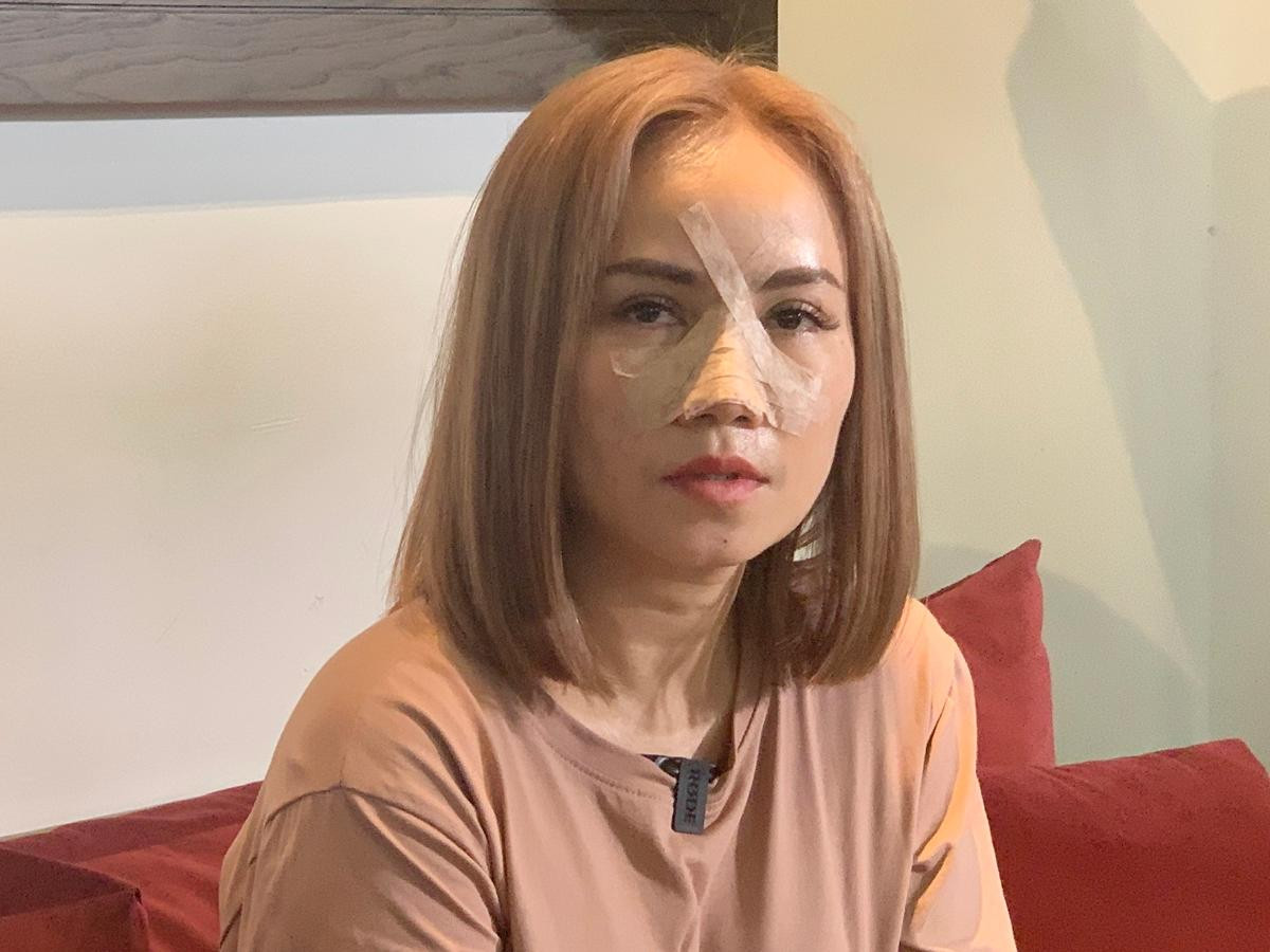 Hoàng Yến sau khi bị chồng cũ đánh. Hoàng Yến sau khi bị chồng cũ đánh.