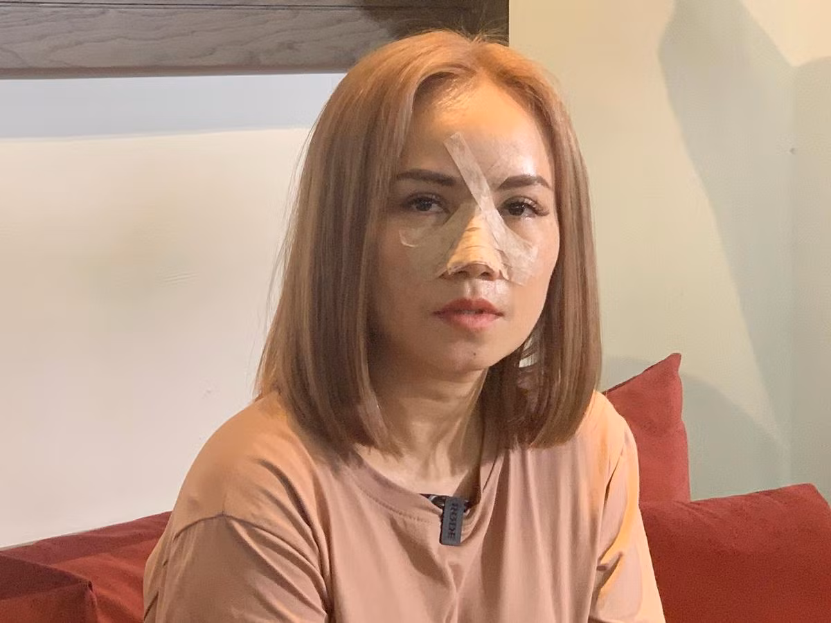 Hoàng Yến sau khi bị chồng cũ đánh.