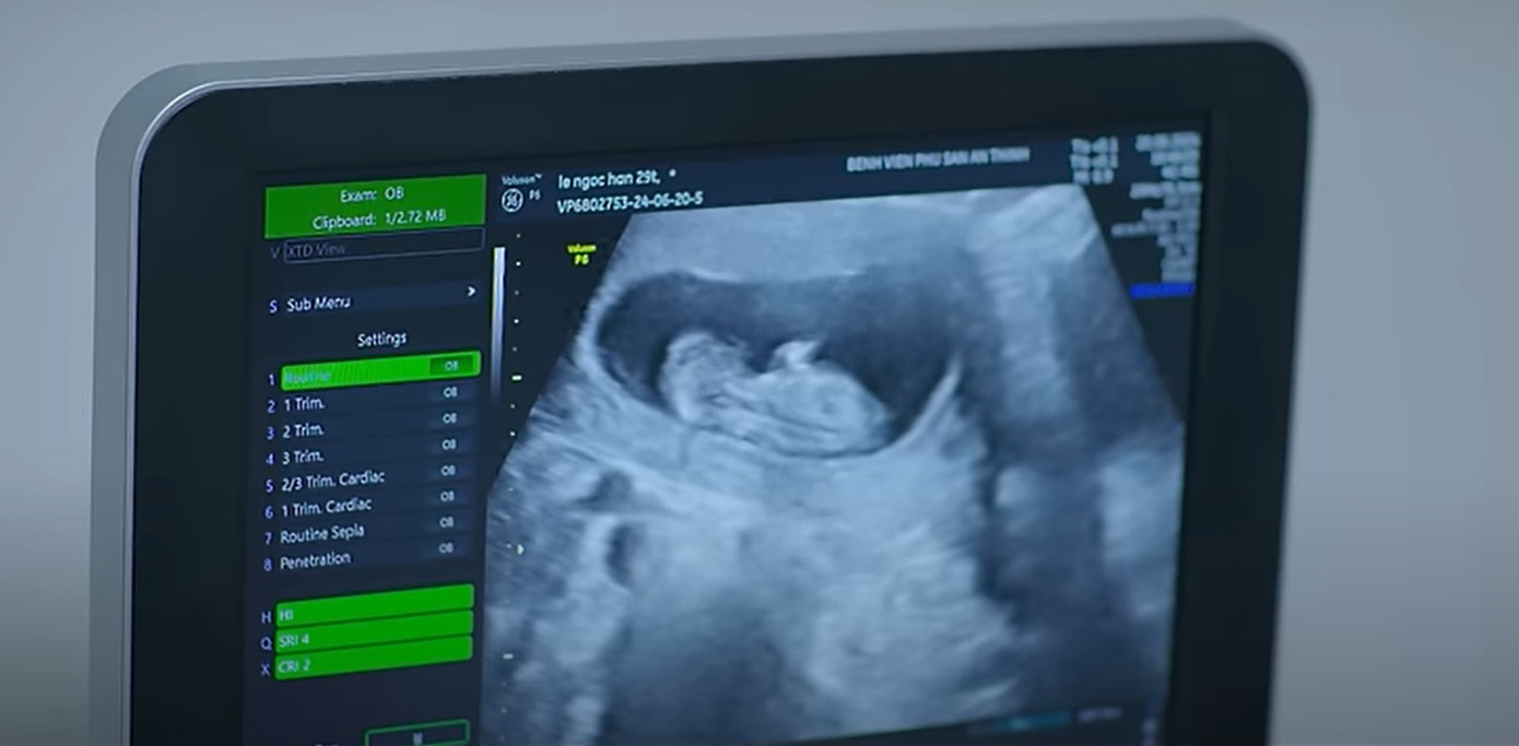 Khán giả phát hiện chi tiết không đúng trong cảnh Đức Anh và Hân đi siêu âm thai. Khán giả phát hiện chi tiết không đúng trong cảnh Đức Anh và Hân đi siêu âm thai.