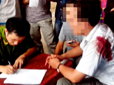 Uống rượu say, vi phạm giao thông nhưng khi bị tuýt còi nam thanh niên rồ ga bỏ chạy buộc cảnh sát bắn đạn cao su trấn áp. Ảnh: chỉ mang tính minh họa Uống rượu say, vi phạm giao thông nhưng khi bị tuýt còi hai nam thanh niên rồ ga bỏ chạy buộc cảnh sát bắn đạn cao su trấn áp