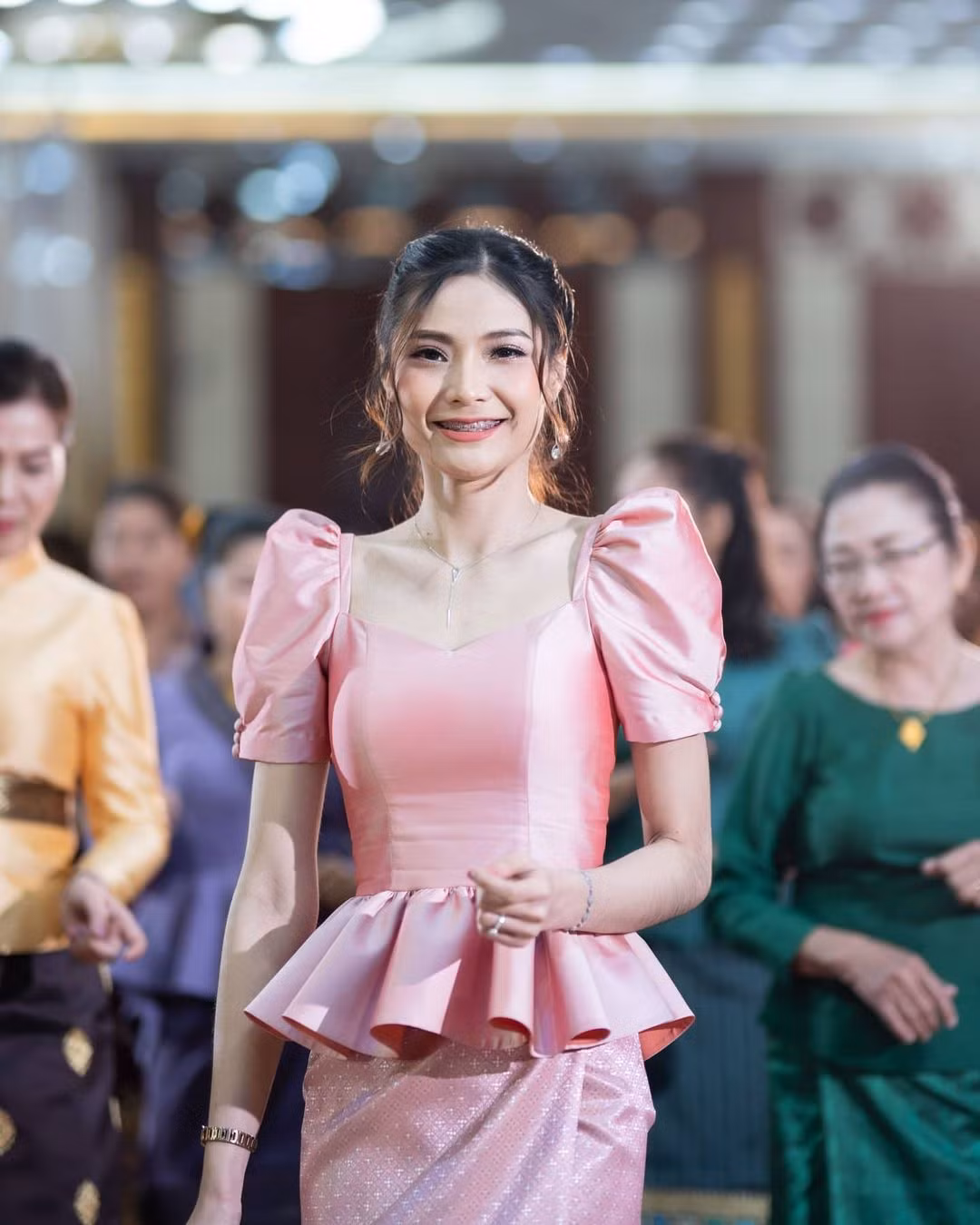 Người đẹp cũng từng niềng răng để có nụ cười rạng rỡ.