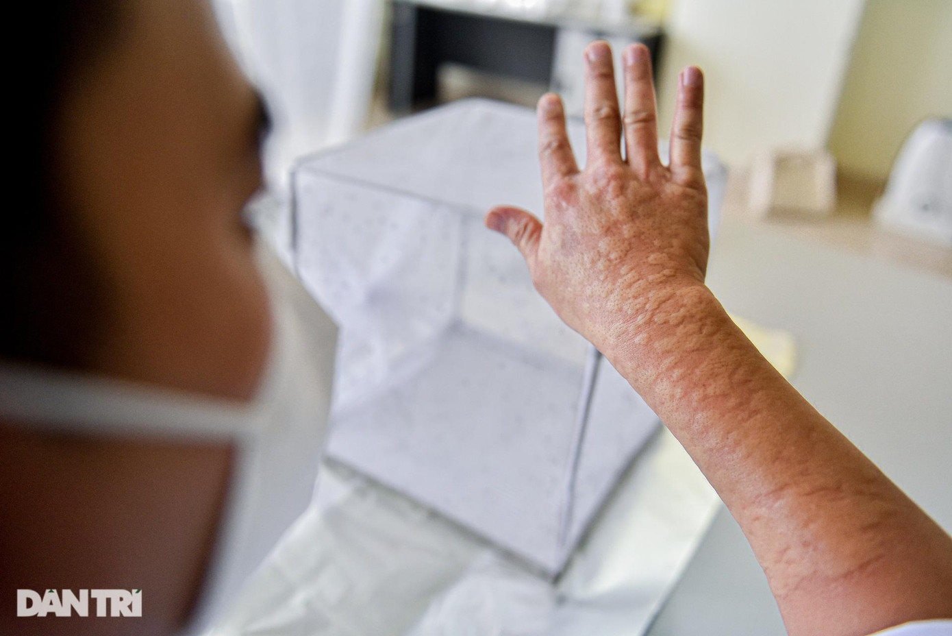 Dù bị muỗi đốt tới run người, phải nghiến chặt răng nhưng anh mong muỗi được hút no máu để chúng phát triển tốt, đẻ trứng chất lượng, nhờ đó đem lại thuận lợi cho quá trình nghiên cứu, phòng chống dịch bệnh.