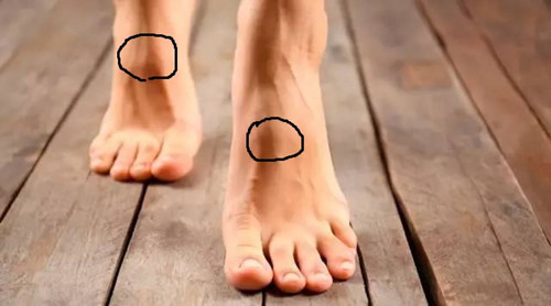 Mẹo đơn giản tự kiểm tra có huyết khối nguy hiểm hay không ảnh 1