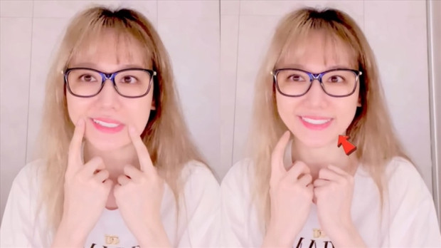 Hari Won gặp phải tình trạng này do thiếu ngủ kéo dài. Hari Won gặp phải tình trạng này do thiếu ngủ kéo dài.