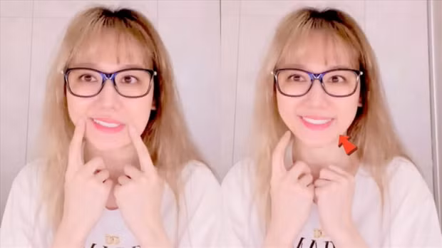 Hari Won gặp phải tình trạng này do thiếu ngủ kéo dài.