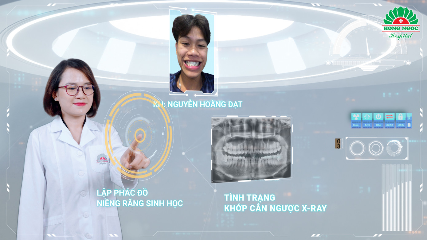 Niềng răng sinh học và niềng răng thông thường khác nhau ở khí cụ và nguyên lý chỉnh nha, từ đó tạo nên sự khác biệt lớn trong phác đồ điều trị và kết quả đạt được. Niềng răng sinh học và niềng răng thông thường khác nhau ở khí cụ và nguyên lý chỉnh nha, từ đó tạo nên sự khác biệt lớn trong phác đồ điều trị và kết quả đạt được.