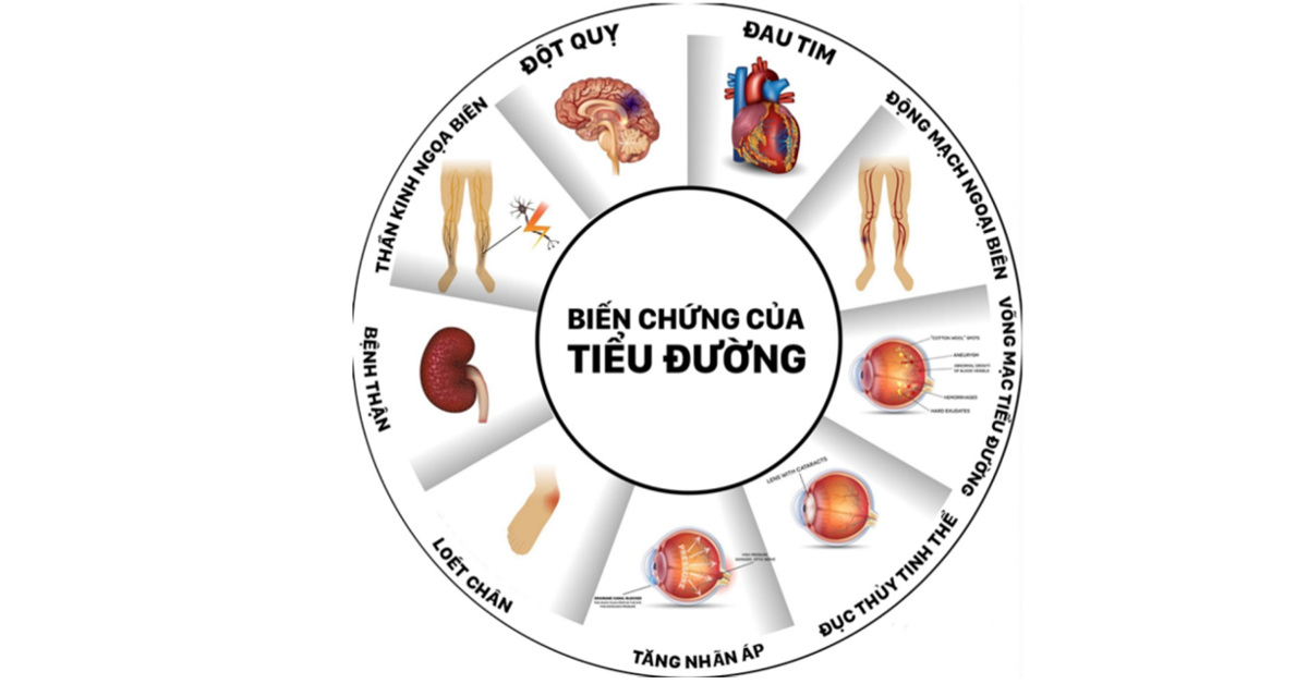 Biến chứng nguy hiểm thường gặp của đái tháo đường Biến chứng nguy hiểm thường gặp của đái tháo đường