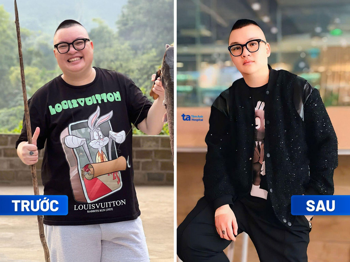 Anh Hà Đức Minh giảm 12kg, ổn định chỉ số mỡ máu, đường huyết trong ngưỡng an toàn sau 3 tháng điều trị tại Trung tâm Giảm cân Tâm Anh. BVĐK Tâm Anh