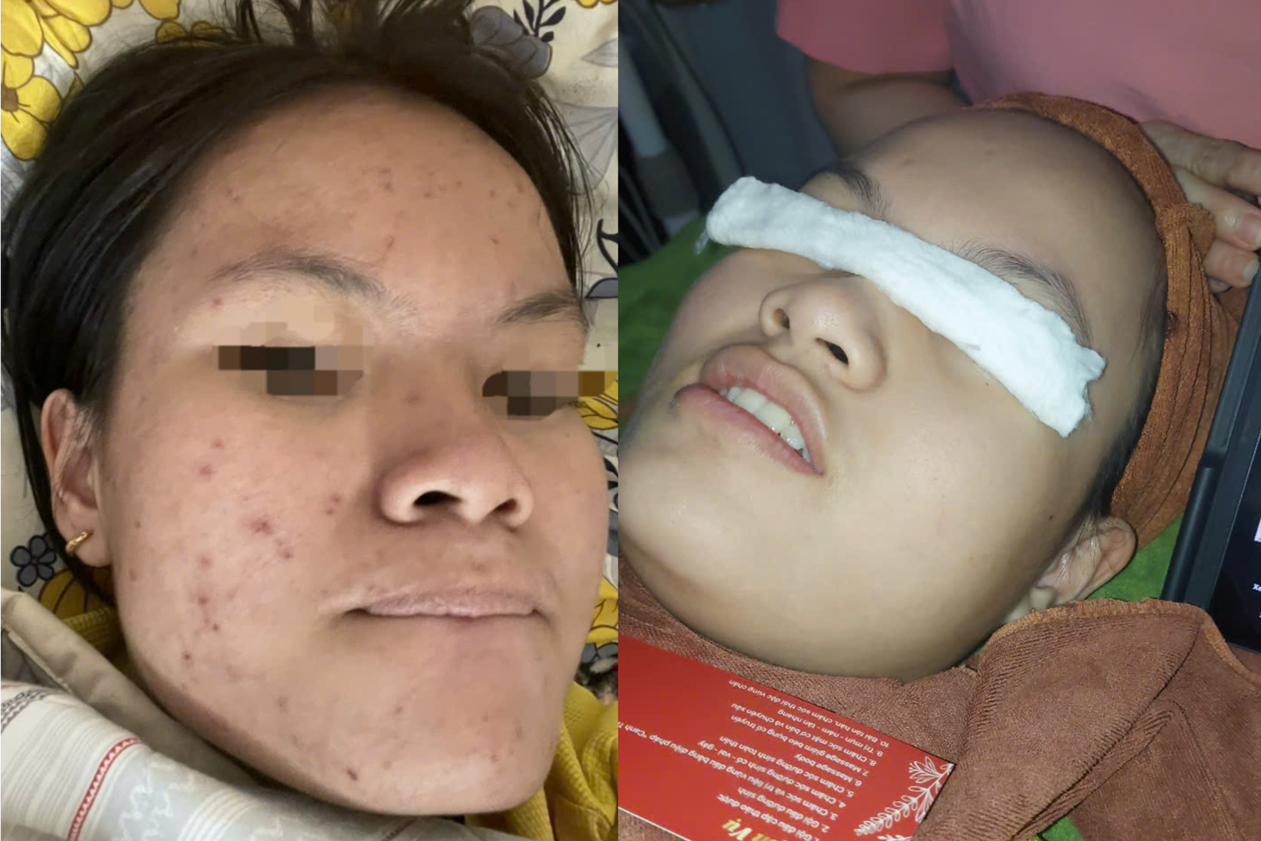 Lộ trình điều trị da mụn của spa 86 Tân Châu Tây Ninh được nhiều khách hàng tin tưởng Lộ trình điều trị da mụn của spa 86 Tân Châu Tây Ninh được nhiều khách hàng tin tưởng