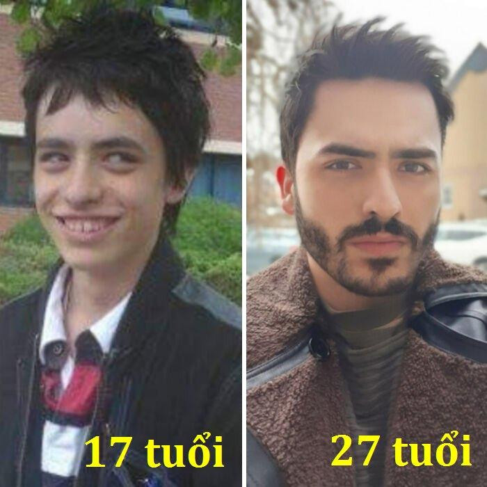 Ai mà ngờ được sau 10 năm, chàng trai này lại đẹp trai ngời ngời như thế này chứ. Ai mà ngờ được sau 10 năm, chàng trai này lại đẹp trai ngời ngời như thế này chứ.