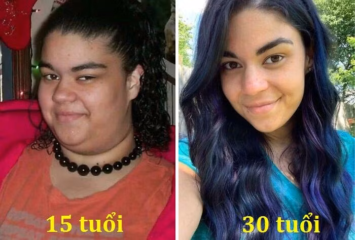 Giảm cân luôn khiến chúng ta trẻ ra, cô gái này chính là một minh chứng sống.
