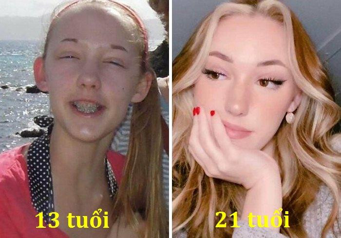 Niềng răng phải chăng là vũ khí bí mật của cô nàng này? Niềng răng phải chăng là vũ khí bí mật của cô nàng này?