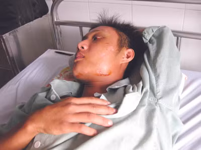 Nạn nhân một vụ thanh toán của giới giang hồ đất Mỏ