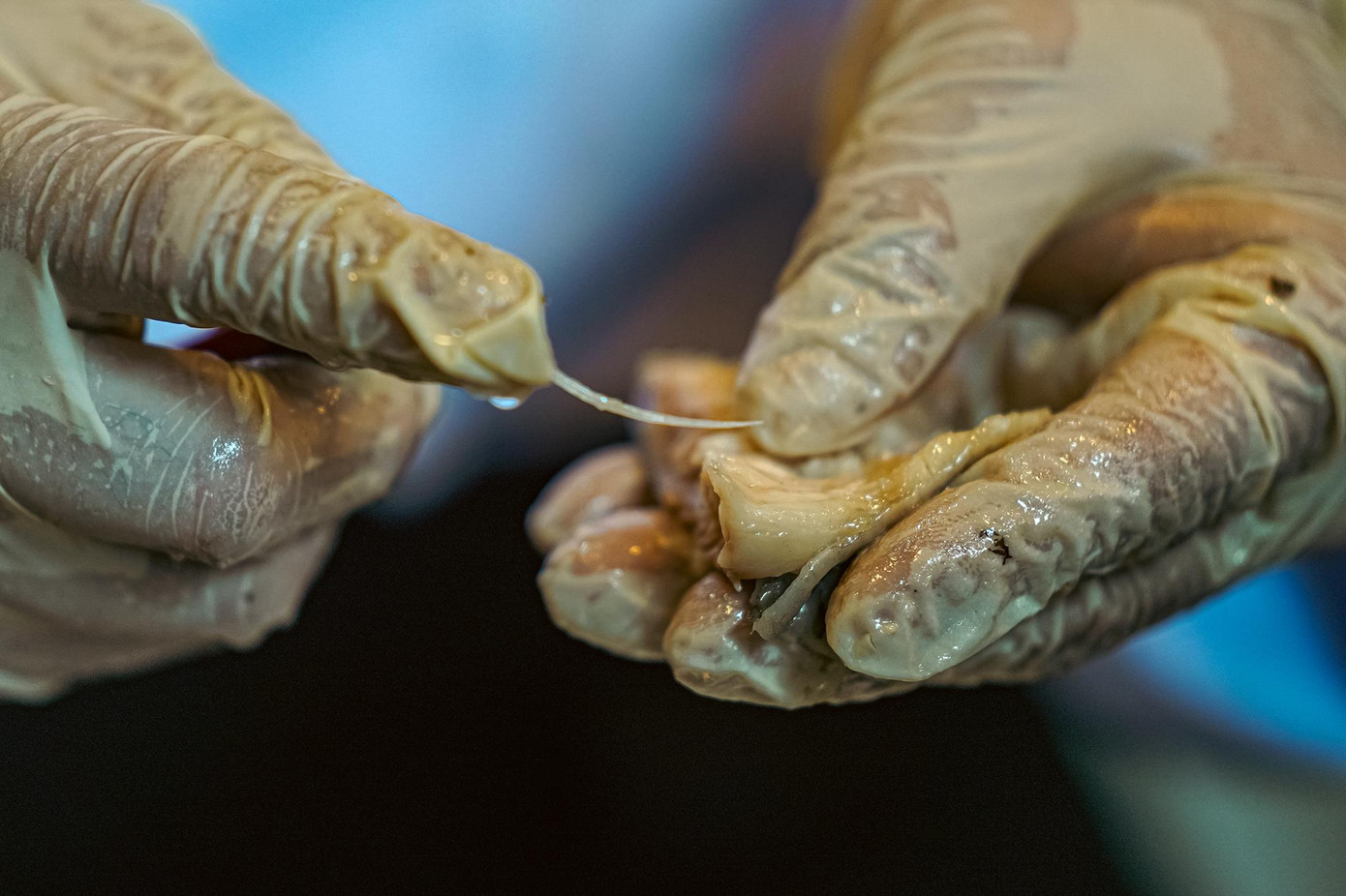 Mỗi phần thịt phi lê có khoảng 25 chiếc xương cá lớn nhỏ.