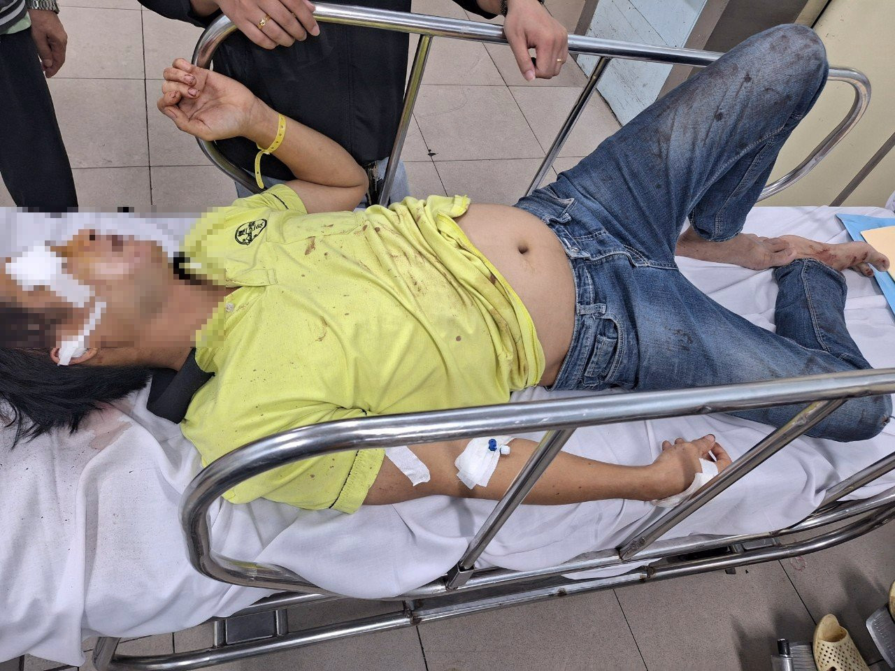 Nạn nhân Thành đang được cấp cứu ở bệnh viện Chợ Rẫy Nạn nhân Thành đang được cấp cứu ở bệnh viện Chợ Rẫy