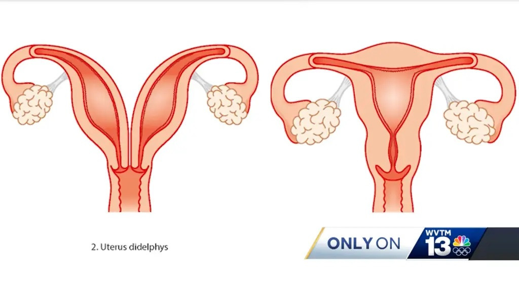 Rất hiếm người có hai tử cung như thế này.