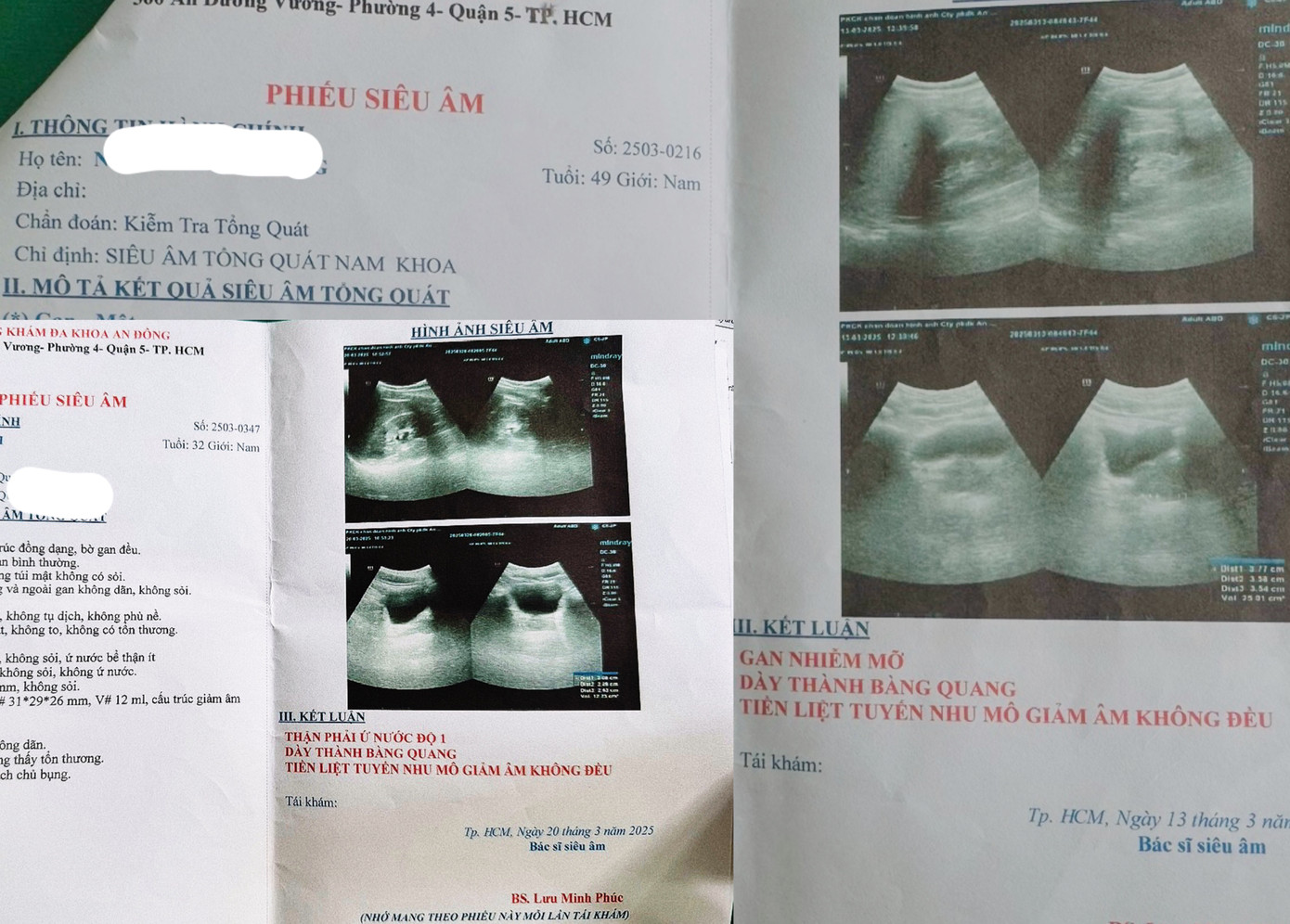 Kết quả siêu âm của phóng viên và bệnh nhân H. "vô tình" lại như nhau- ảnh P.V Kết quả siêu âm của phóng viên và bệnh nhân H. "vô tình" lại như nhau- ảnh P.V