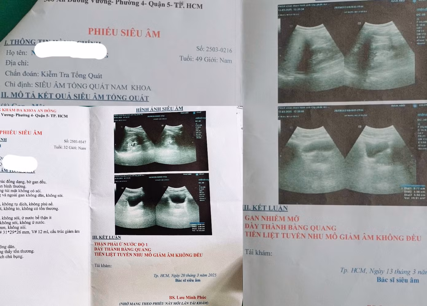 Cơ sở không chỉ hù dọa bệnh nhân nhằm vẽ bệnh moi tiền mà còn “nhân bản” kết quả siêu âm, xét nghiệm Cơ sở không chỉ hù dọa bệnh nhân nhằm vẽ bệnh moi tiền mà còn “nhân bản” kết quả siêu âm, xét nghiệm