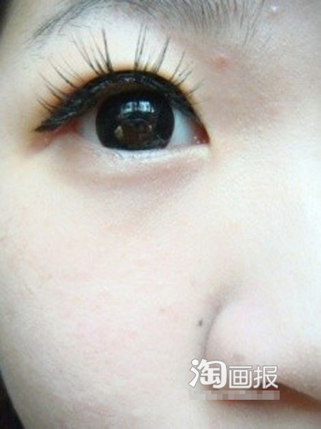 Hình ảnh đôi mắt nhìn lên khi dán miếng dính thứ 2