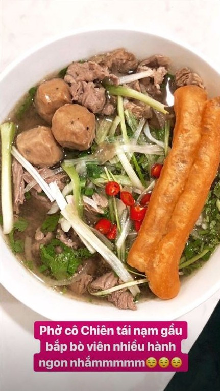 Ca sĩ Tóc Tiên phải nhập viện vì bỏng cấp độ 2 ở cánh tay và mắt ảnh 4