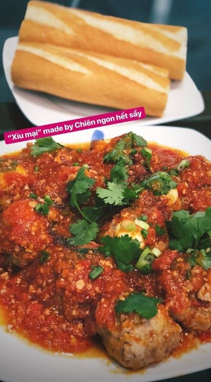 Ca sĩ Tóc Tiên phải nhập viện vì bỏng cấp độ 2 ở cánh tay và mắt ảnh 5