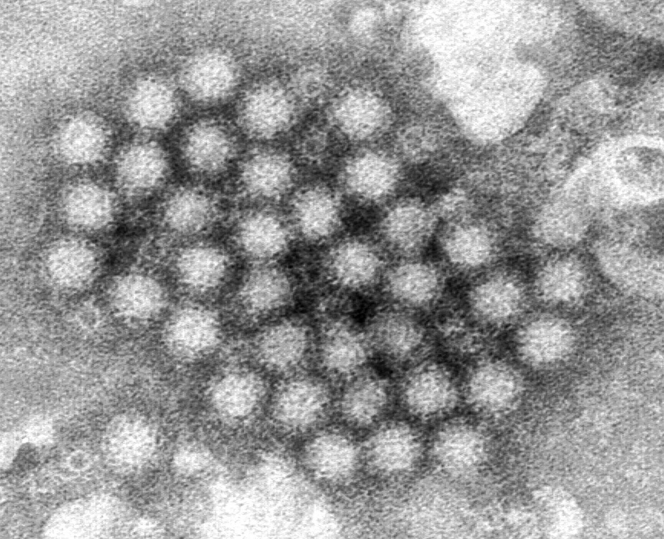 Hình ảnh chụp bằng kính hiển vi điện tử do CDC cung cấp cho thấy một cụm virion norovirus.
