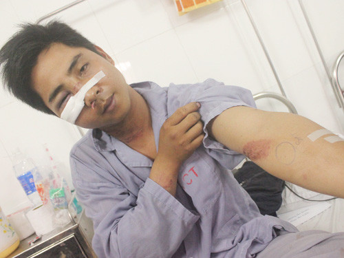 Anh Nghiêm Duy Hoàng điều trị tại bệnh viện với nhiều vết thương trên người. Ảnh: Thế Kha - NLĐ 