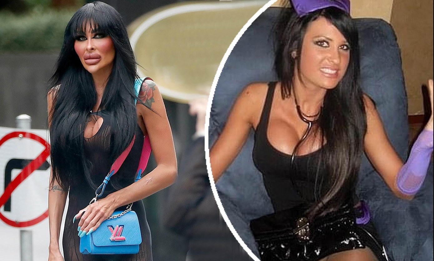 Trước khi trở thành "thảm họa thẩm mỹ", Tara là một phụ nữ có ngoại hình ưa nhìn, nóng bỏng.