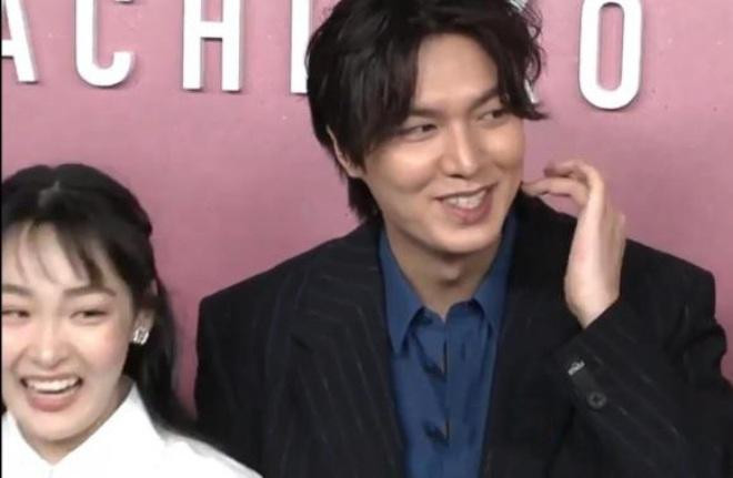 Anh còn lộ gương mặt sưng phù, đơ cứng thiếu tự nhiên.