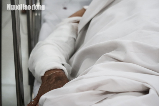 Cụ ông 70 tuổi tạt axít vào mặt vợ vì cuồng ghen ảnh 2