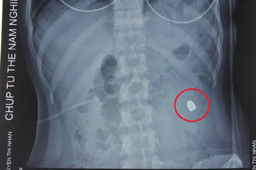 Nổ súng tại quán karaoke, 2 người dân trọng thương ảnh 1