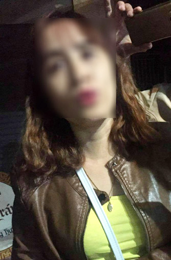 Bé trai bị bố đánh gãy xương, rạn sọ: Giảm 20kg vì bị bạo hành ảnh 2