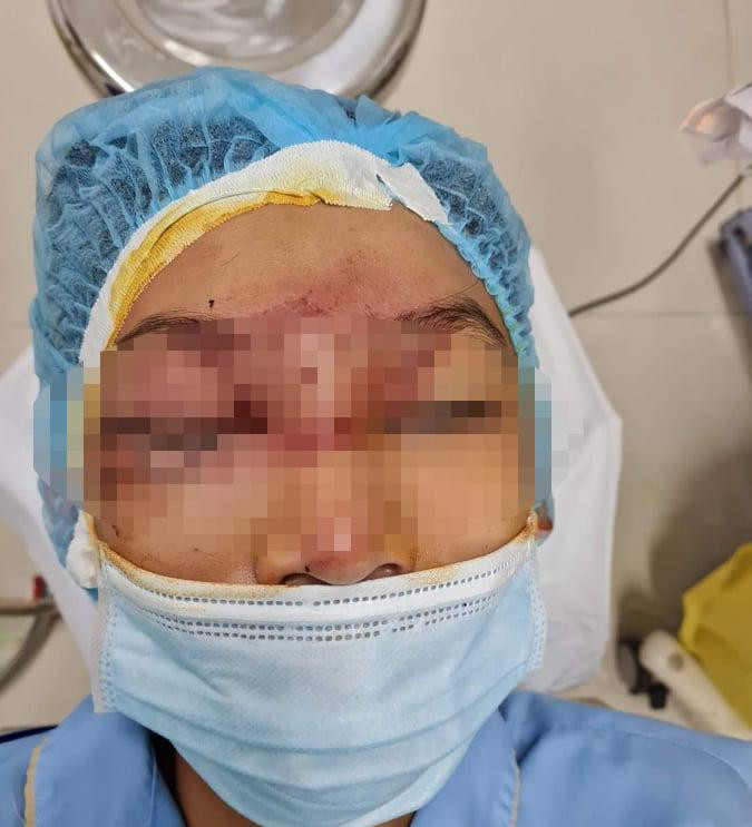 Bé trai 14 tuổi đang được cấp cứu ở Bệnh viện Mắt Tây Nguyên Bé trai 14 tuổi đang được cấp cứu ở Bệnh viện Mắt Tây Nguyên