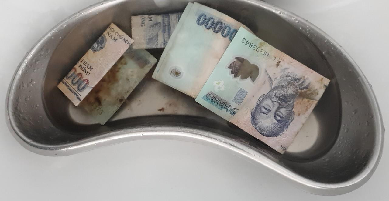 Số tiền lấy trong bụng chị H.