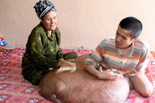 Bà Nguyễn Thị Cho Con chăm sóc anh Hải