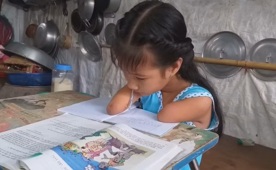 Nghị lực phi thường của cô bé khiếm khuyết tay chân ảnh 1