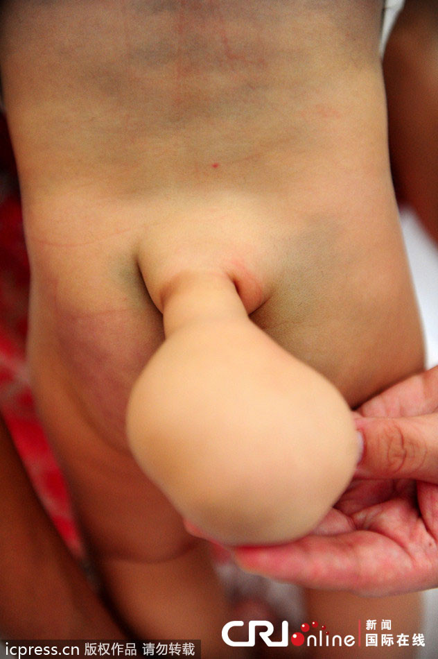 Chiếc đuôi dài 10cm của Tiểu Vỹ