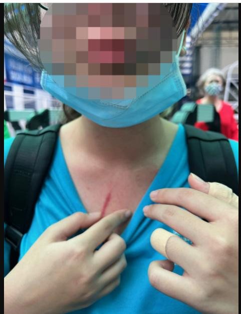 Hình ảnh vết thương của học sinh sau khi xô xát Hình ảnh vết thương của học sinh sau khi xô xát