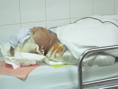 Nạn nhân được điều trị tại bệnh viện. Nạn nhân được điều trị tại bệnh viện