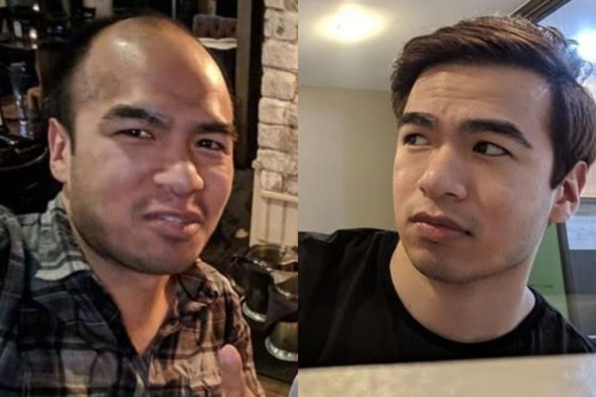 Việc cấy tóc đã giúp cuộc sống của doanh nhân Saul Trejor hoàn toàn thay đổi (Ảnh: Saul Trejor).