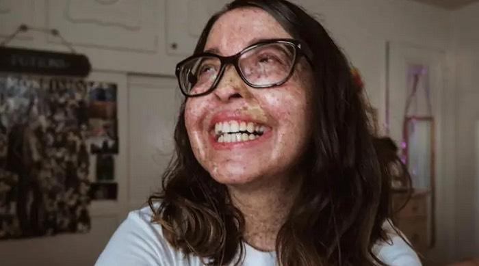 Cô gái 28 tuổi luôn giữ vững tinh thần lạc quan, sống tích cực. Cô gái 28 tuổi luôn giữ vững tinh thần lạc quan, sống tích cực.